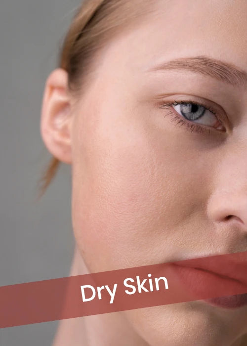 Dry Skin