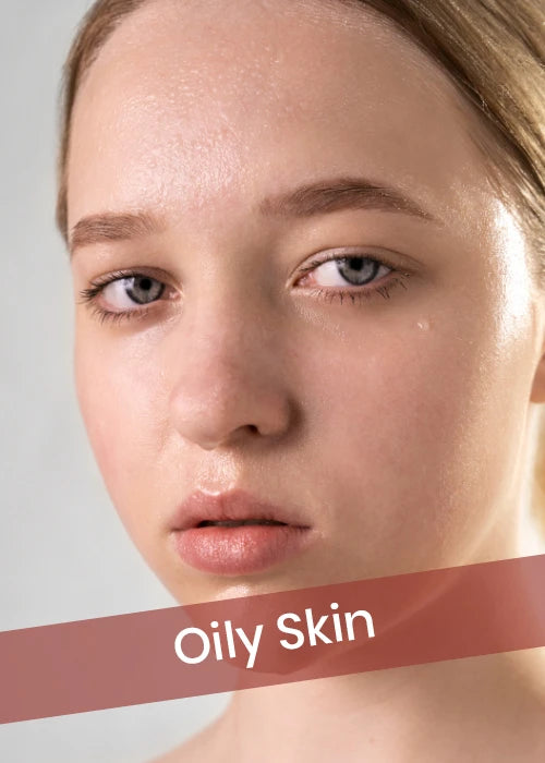 Oily Skin