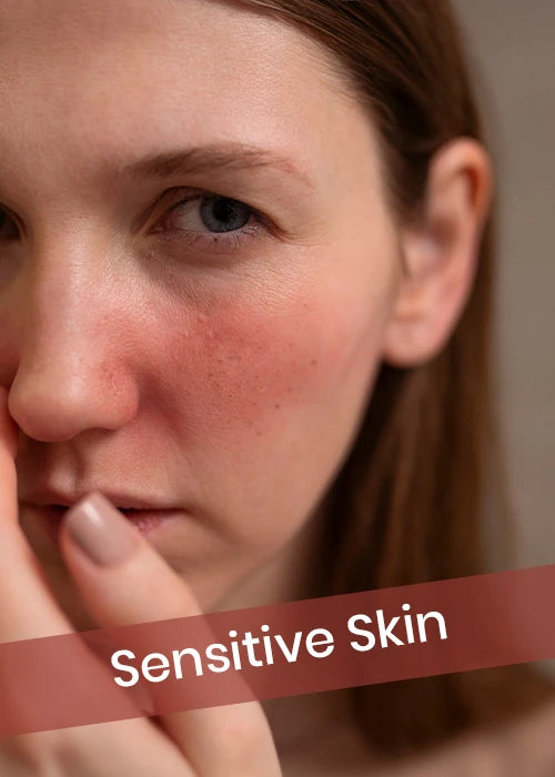 Sensitive Skin