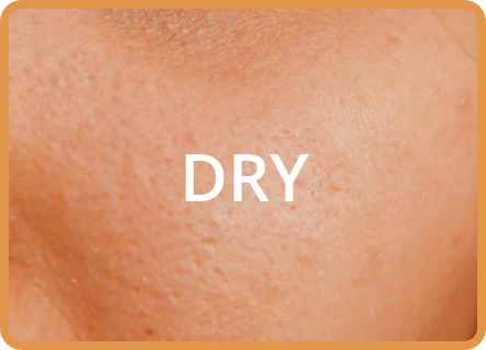 Sunscreen for Dry Skin