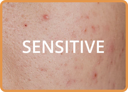 Sunscreen for Sensitive Skin