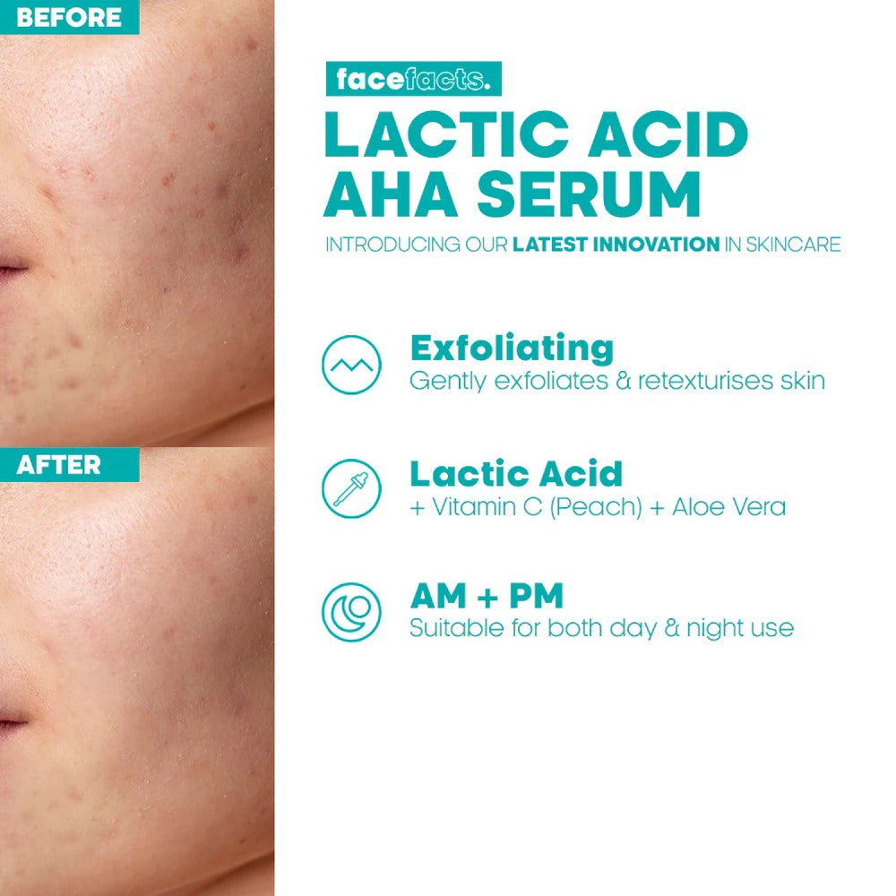 FACE FACTS FACIAL SERUM LACTIC ACID AHA 30 ML