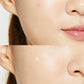 COSRX ACNE PIMPLE MASTER PATCH
